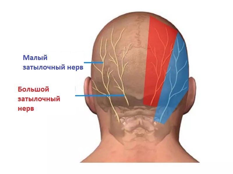 Виды головных болей